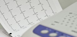 EKG