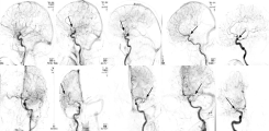 Exemplarische Frames aus Angiographien mit aufsteigenden Verschlussgraden