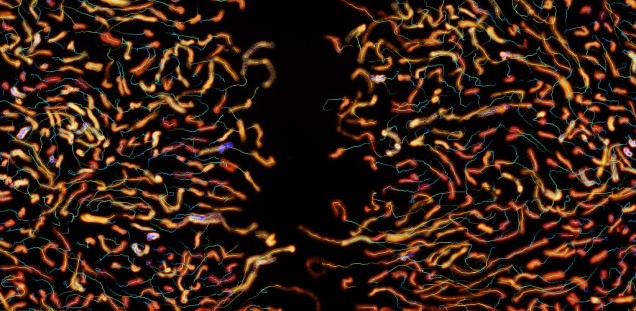 Time projection and tracking of collective cell migration during wound healing.