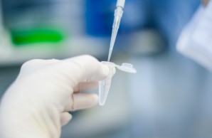 Eine Pipette wird in ein Plastikröhrchen gehalten