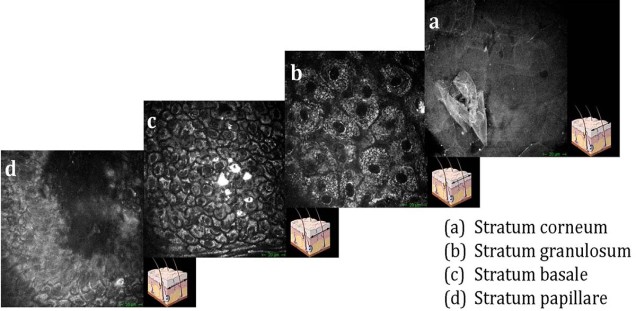 Multiphotonentomographische Aufnahme der Haut eines gesunden Probanden