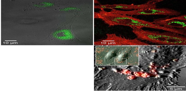 Subzelluläre Lokalisation von Nanopartikeln in HUVEC