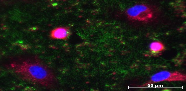 Melanomadhäsion am Endothel via VWF