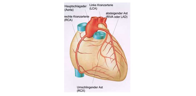 AG Koronarchirurgie