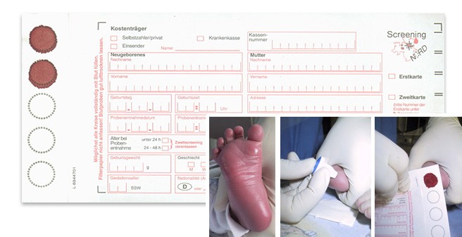 Neugeborenenscreening und Stoffwechsellabor